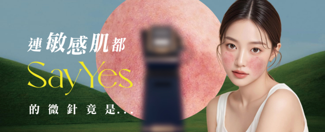 Sylfirm X 黃金微針療程示範，敏感肌適用的射頻微針醫美技術